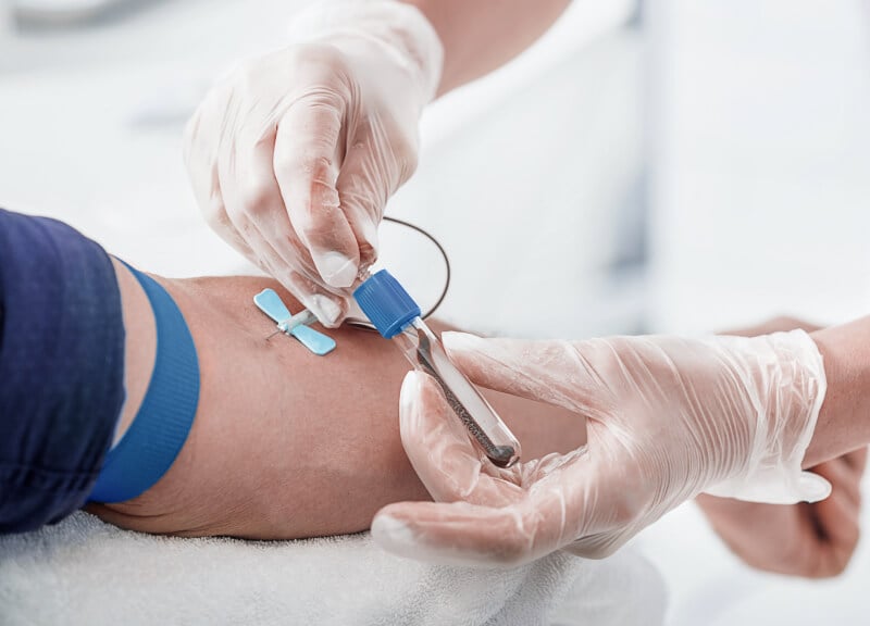 En sundhedsprofessionel med handsker tager blod fra en arm. En blå staseslange er bundet om armen, og en nål er indført i en vene.